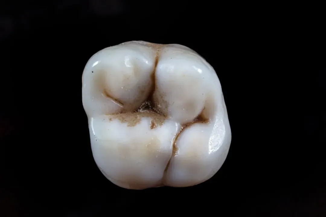 #7 - Teeth Can Track Exactly Where Someone Grew Up (Image Credits: Unsplash)