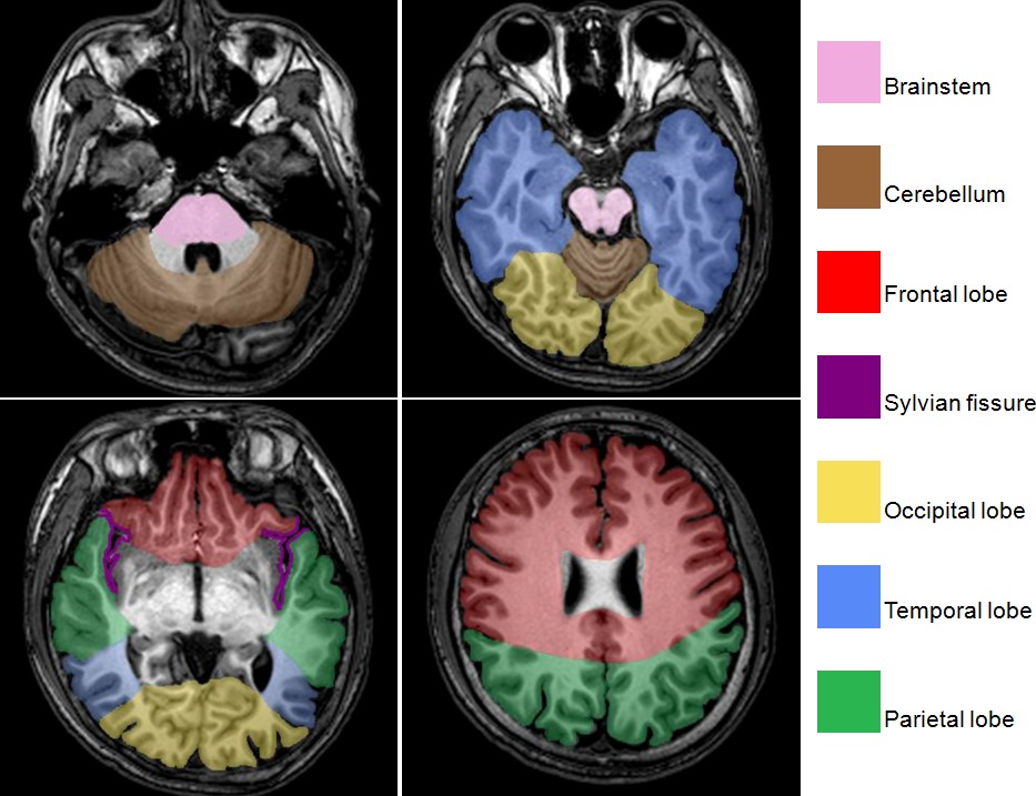 The Key Brain Regions That Shape Your Outlook (Image Credits: Wikimedia)