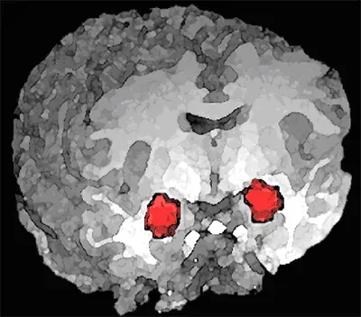 The Brain’s Threat-Detection System Never Retired (By Unknown authorUnknown author, Public domain)