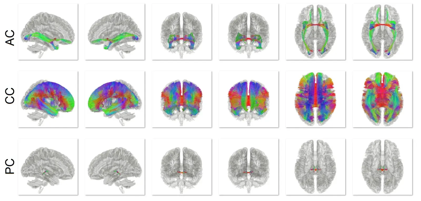 Why This Matters for Memory, Identity, and the Future of Mind Science (By Yeh, F. C., Panesar, S., Fernandes, D., Meola, A., Yoshino, M., Fernandez-Miranda, J. C., ... & Verstynen, T. (2018). Population-averaged atlas of the macroscale human structural connectome and its network topology. NeuroImage, 178, 57-68., CC BY-SA 4.0)