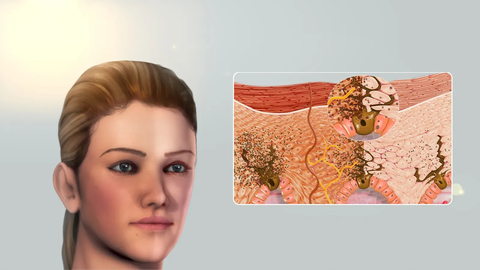 Sun, Pollution, And The Environment Hitting Your Skin First (By http://www.scientificanimations.com/, CC BY-SA 4.0)