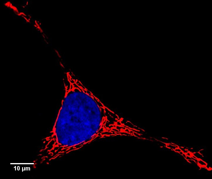Mitochondrial Dysfunction: Power, Sparks, and Slowdowns (Im Credits: Wikimedia)