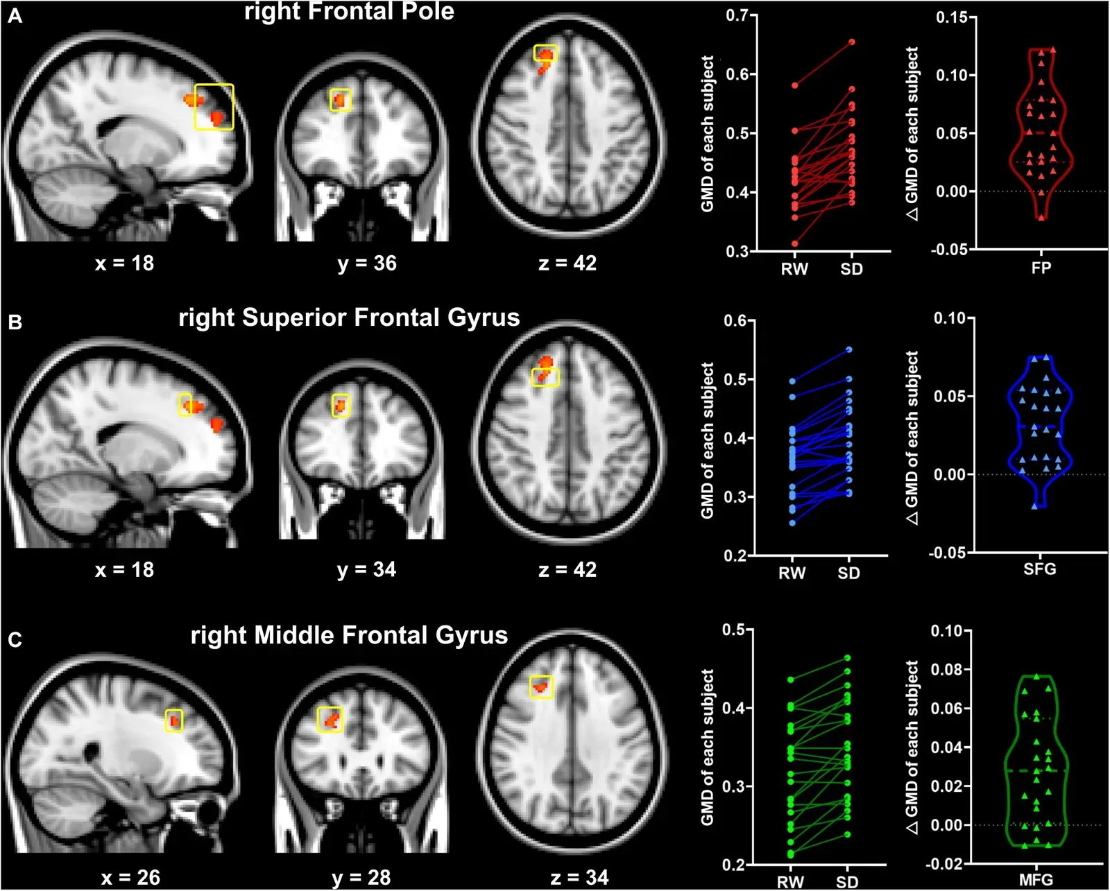 The Hidden Clues: What Happens to a Sleep-Deprived Brain (Image Credits: Wikimedia)