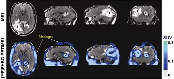Why This Research Feels So Unsettling on a Human Level ([1] Direct
StemBook Figure 7 Human stem cell imaging.Rodriguez-Porcel, M., Wu, J.C., and Gambhir, S.S., Molecular imaging of stem cells (July 30, 2009), StemBook, ed. The Stem Cell Research Community, StemBook, doi/10.3824/stembook.1.49.1, http://www.stembook.org., CC BY 3.0)