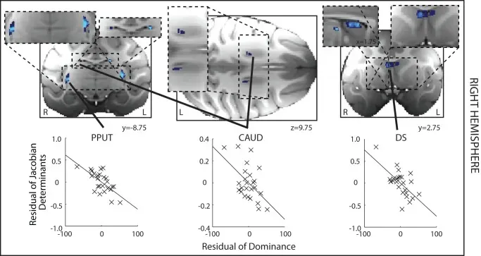 Beyond the EEG: From Ancient Tools to Modern Brain Mapping (Image Credits: Wikimedia)