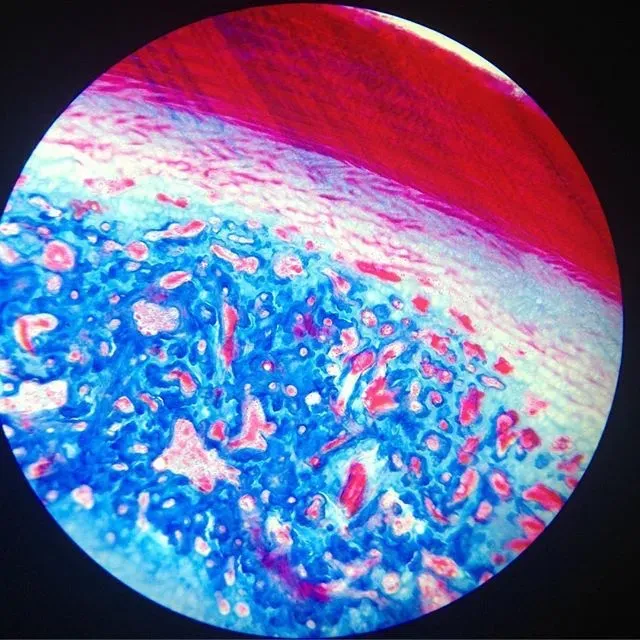 The Interstitium: A Fluid Highway You Never Knew Existed (Image Credits: Wikimedia)