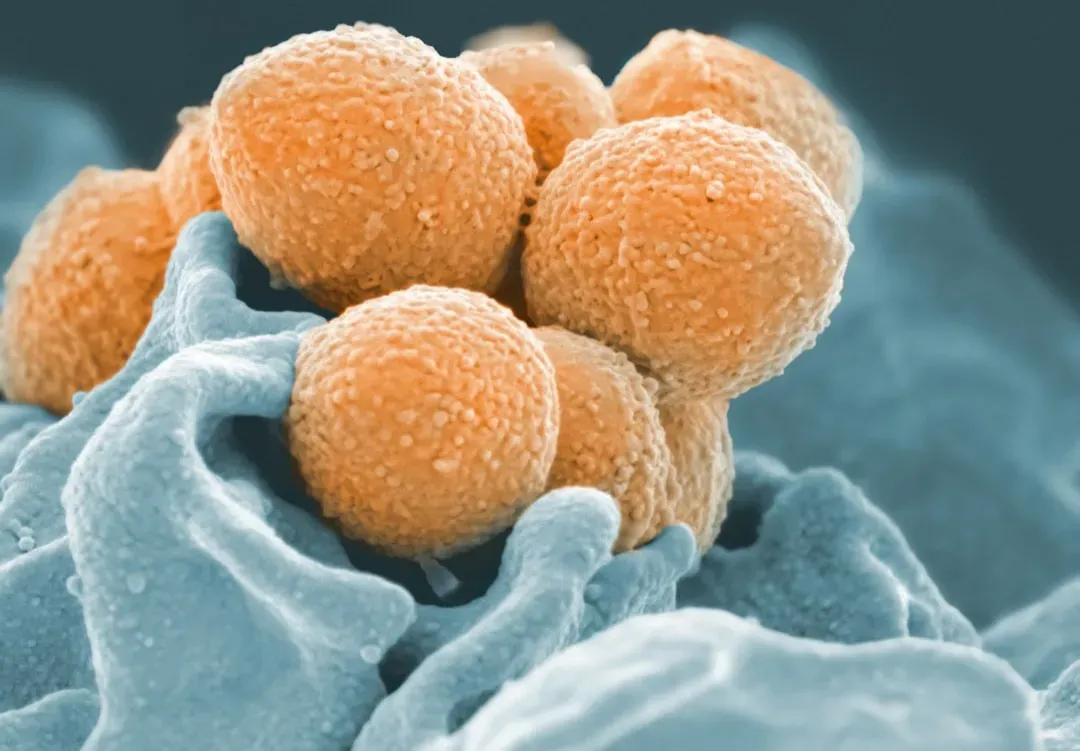 6. Thermophilic Microbes: Micro Life That Loves Extreme Heat (Image Credits: Unsplash)