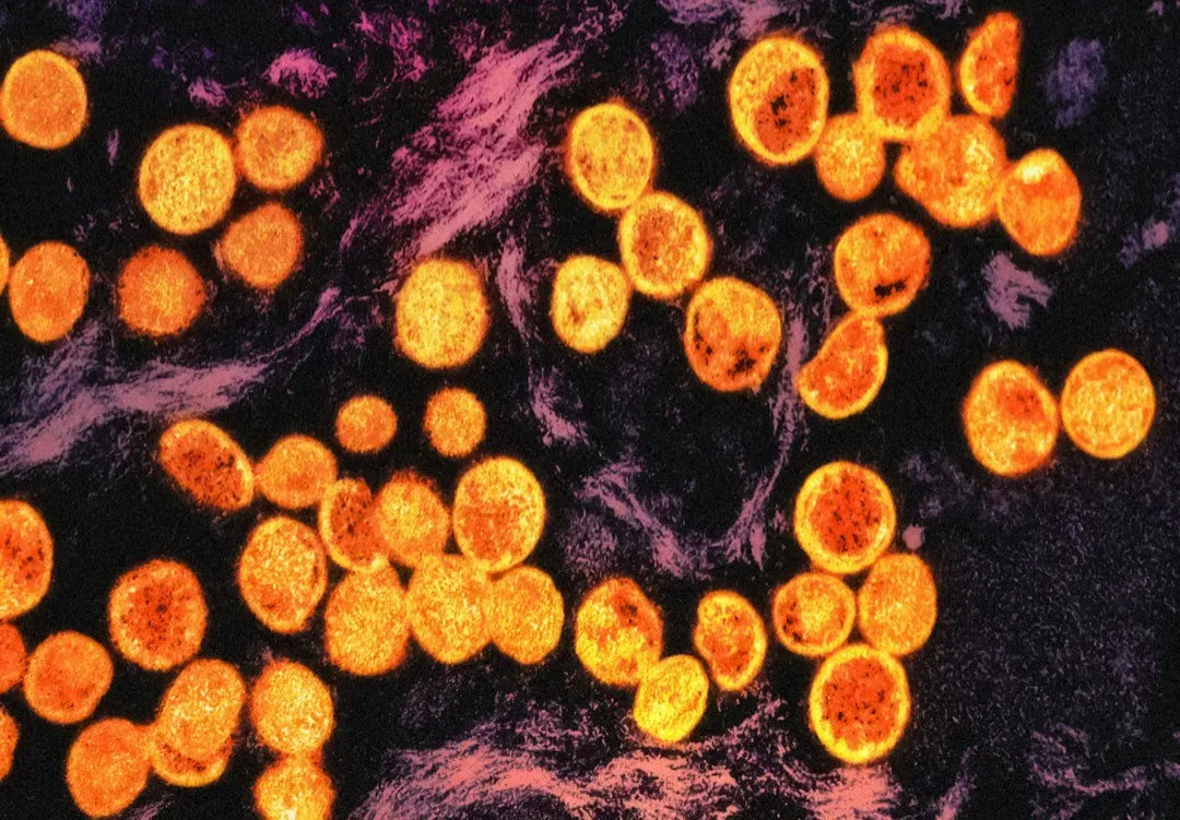 Senolytics: Killing Zombie Cells To Stay Young (Image Credits: Unsplash)