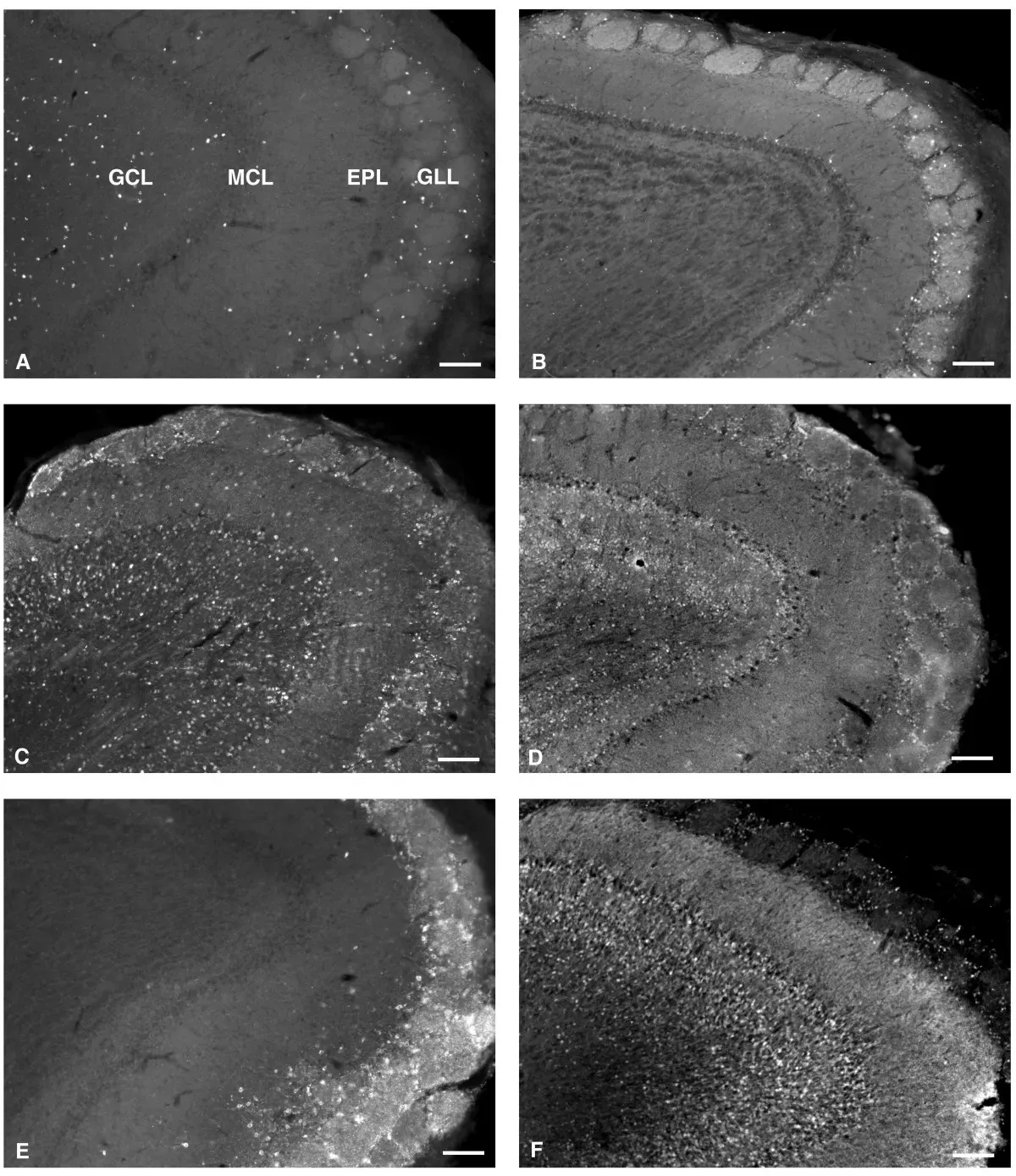 The Future Landscape: From Lifestyle Interventions to Regenerative Therapies (Image Credits: Wikimedia)