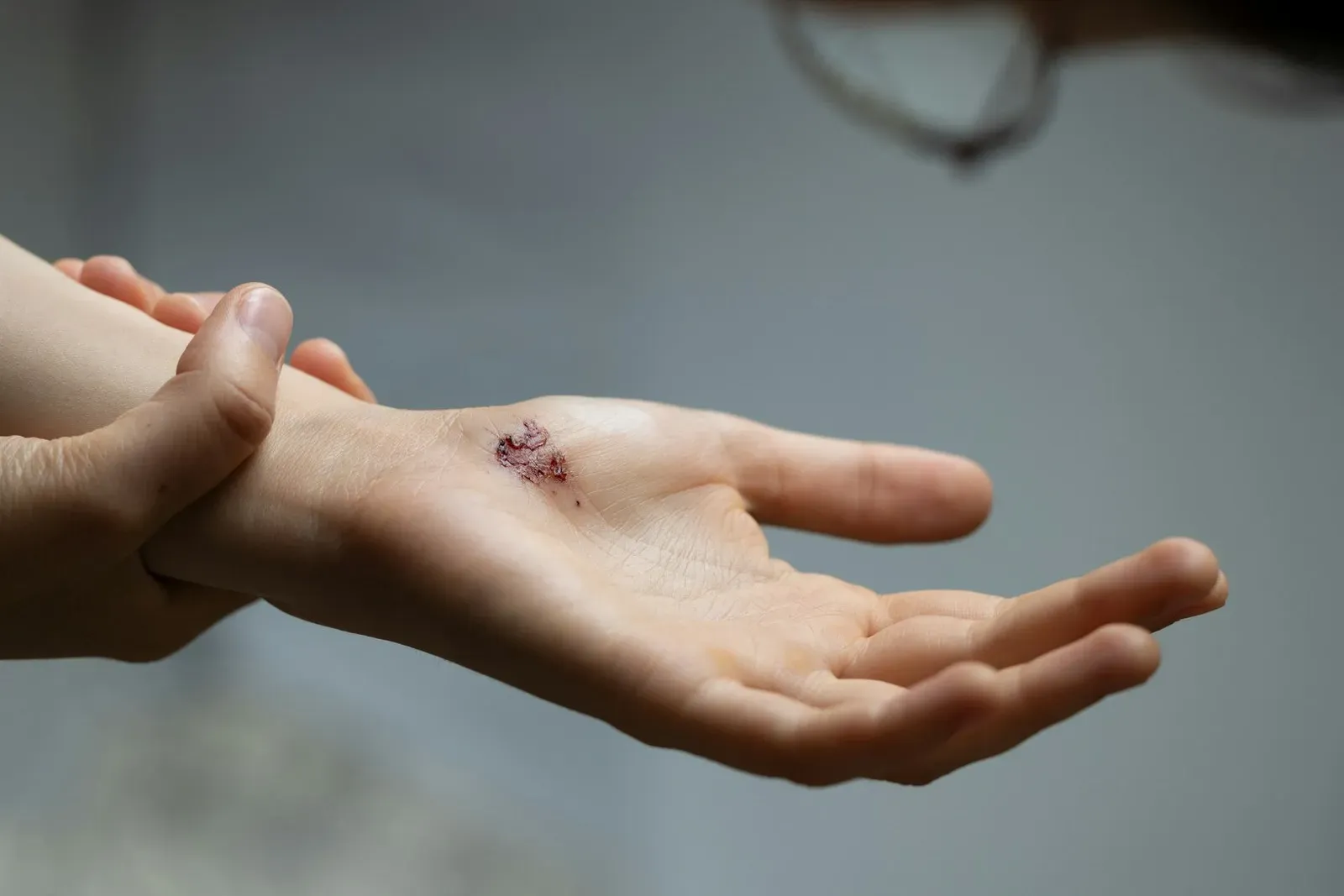 Tissue Repair: Inflammation, Scars, and Recovery (Image Credits: Unsplash)