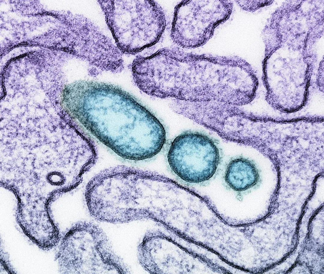 Mitochondrial Breakdown: When the Power Plants Falter (Image Credits: Unsplash)