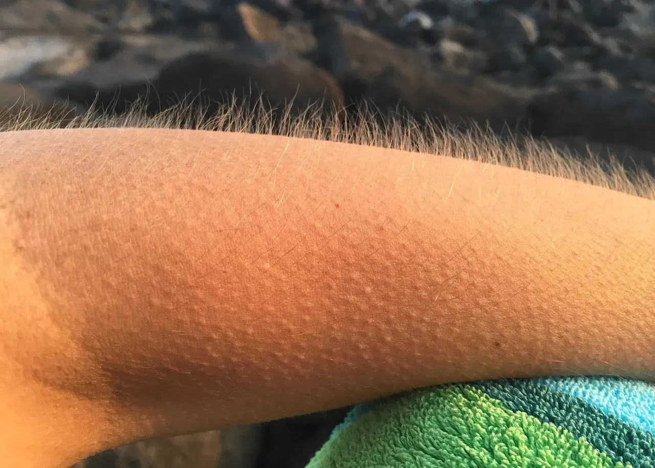 Why You Get Goosebumps From Music Or Strong Emotions (Image Credits: Pixabay)