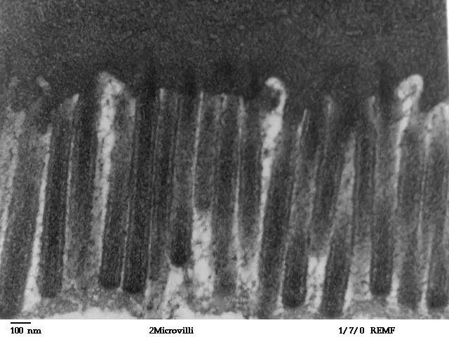 4. Microvilli: Your Nutrient-Absorbing Velvet Carpet (By Louisa Howard, Katherine Connollly, Public domain)