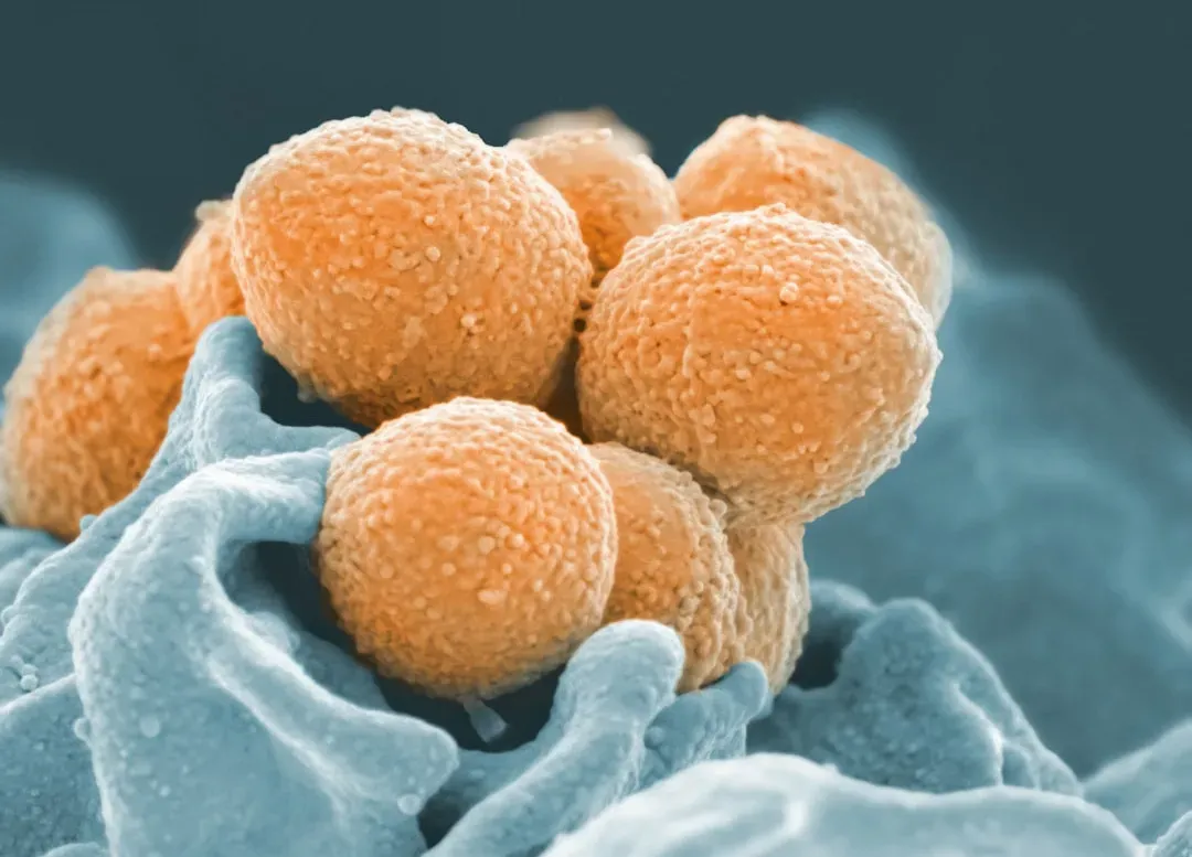 How Microbes Shape Your Immune System and Inflammation (Image Credits: Unsplash)