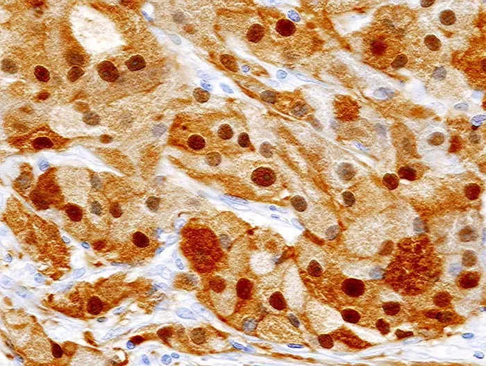 Your Body Is Literally Replacing Itself Right Now (No machine-readable source provided. Own work assumed (based on copyright claims)., CC BY-SA 3.0)