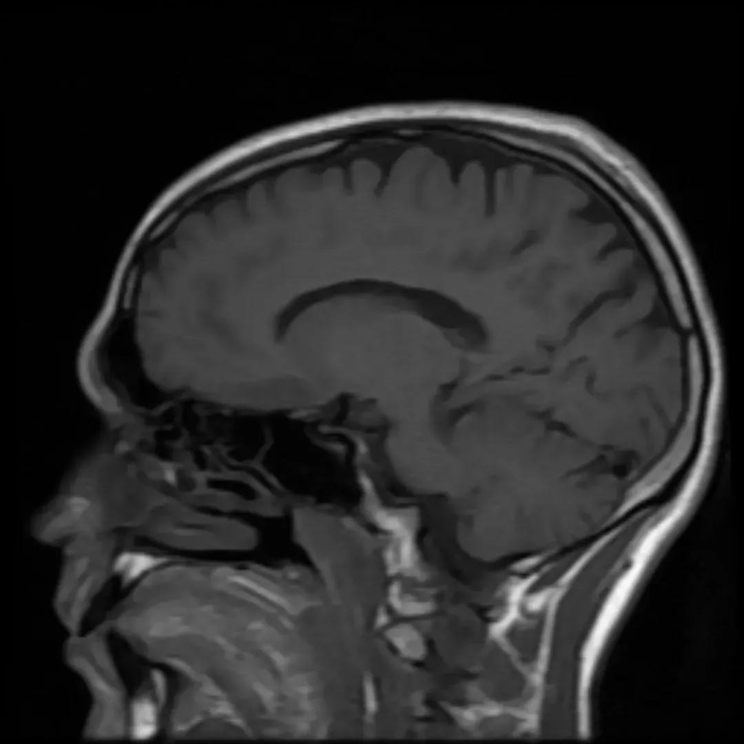 The Hidden Clues: When Brains Don’t Match Experience (Image Credits: Wikimedia)