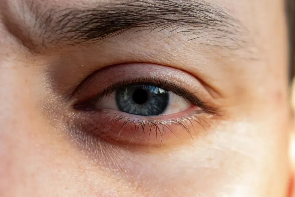 #10 - Fat-Padded, Puffy Eyelids (Image Credits: Pexels)