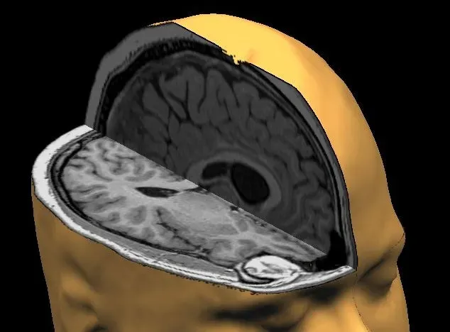 2. The Brain Keeps Editing Memories Every Time You Recall Them (Image Credits: Flickr)