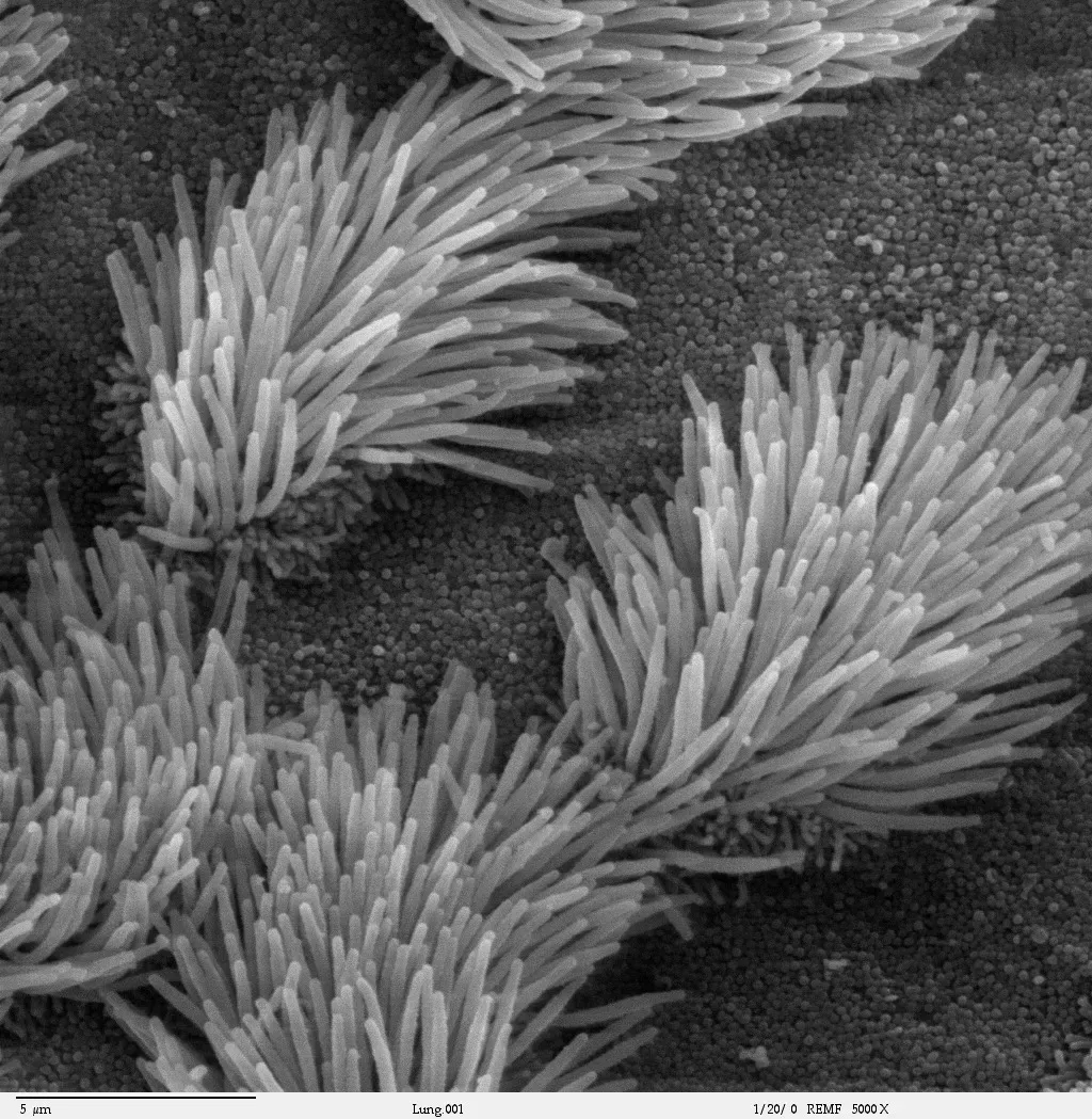 2. Cilia: Microscopic Hair That Quietly Keep You Alive (By Charles Daghlian, Public domain)