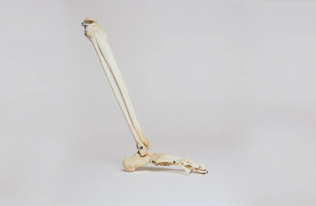 #12 - One Leg Is Noticeably Stronger Than the Other (Image Credits: Unsplash)
