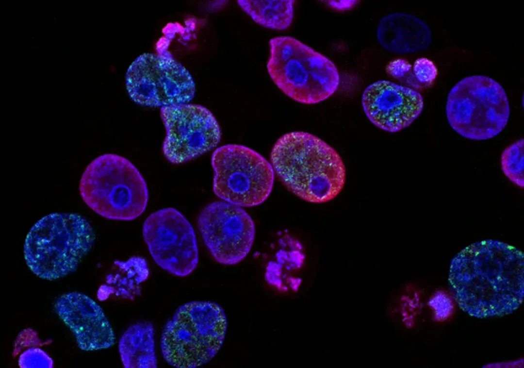 Cellular Senescence: The Zombie Cells Making You Old (Image Credits: Unsplash)