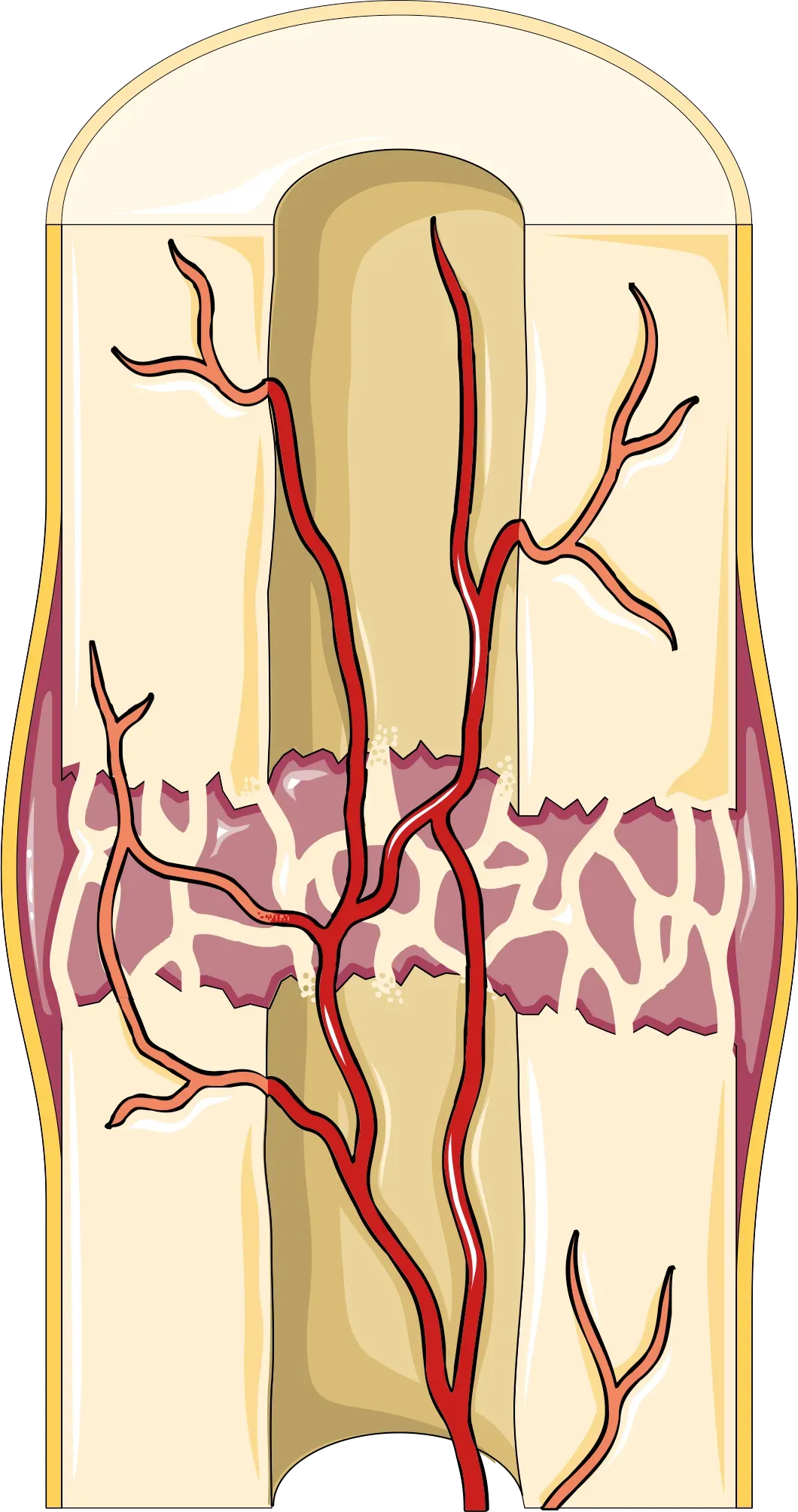The Four-Stage Story of Bone Healing (Image Credits: Wikimedia)
