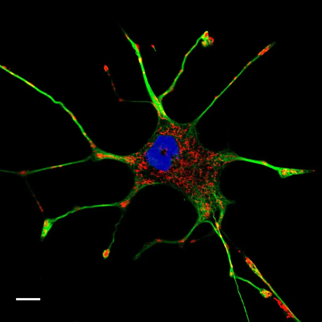 Microtubules: The Unlikely Stars Inside Your Neurons (By 8x57is, CC BY-SA 4.0)