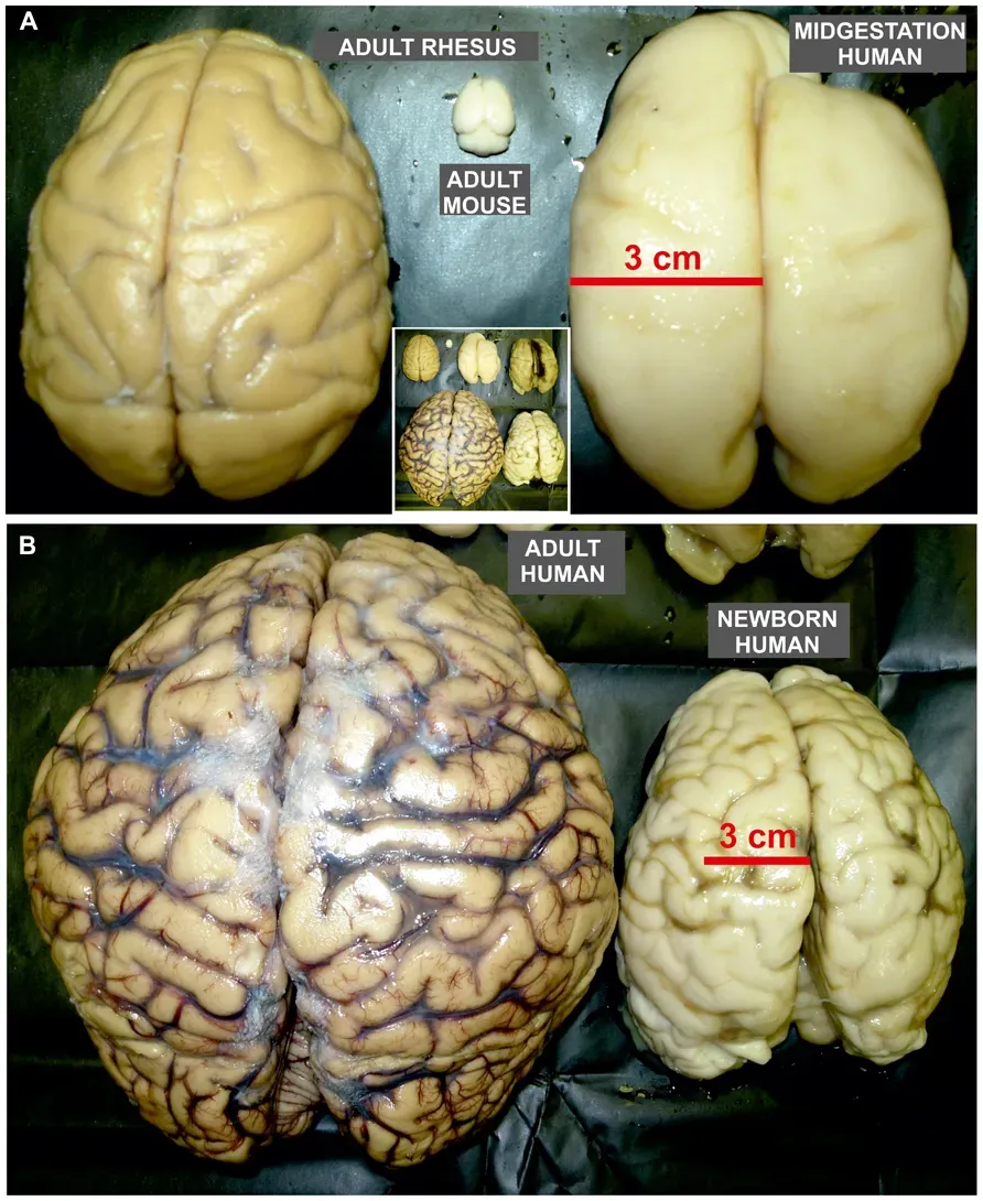 Extreme Plasticity in Childhood Brains (Image Credits: Wikimedia)