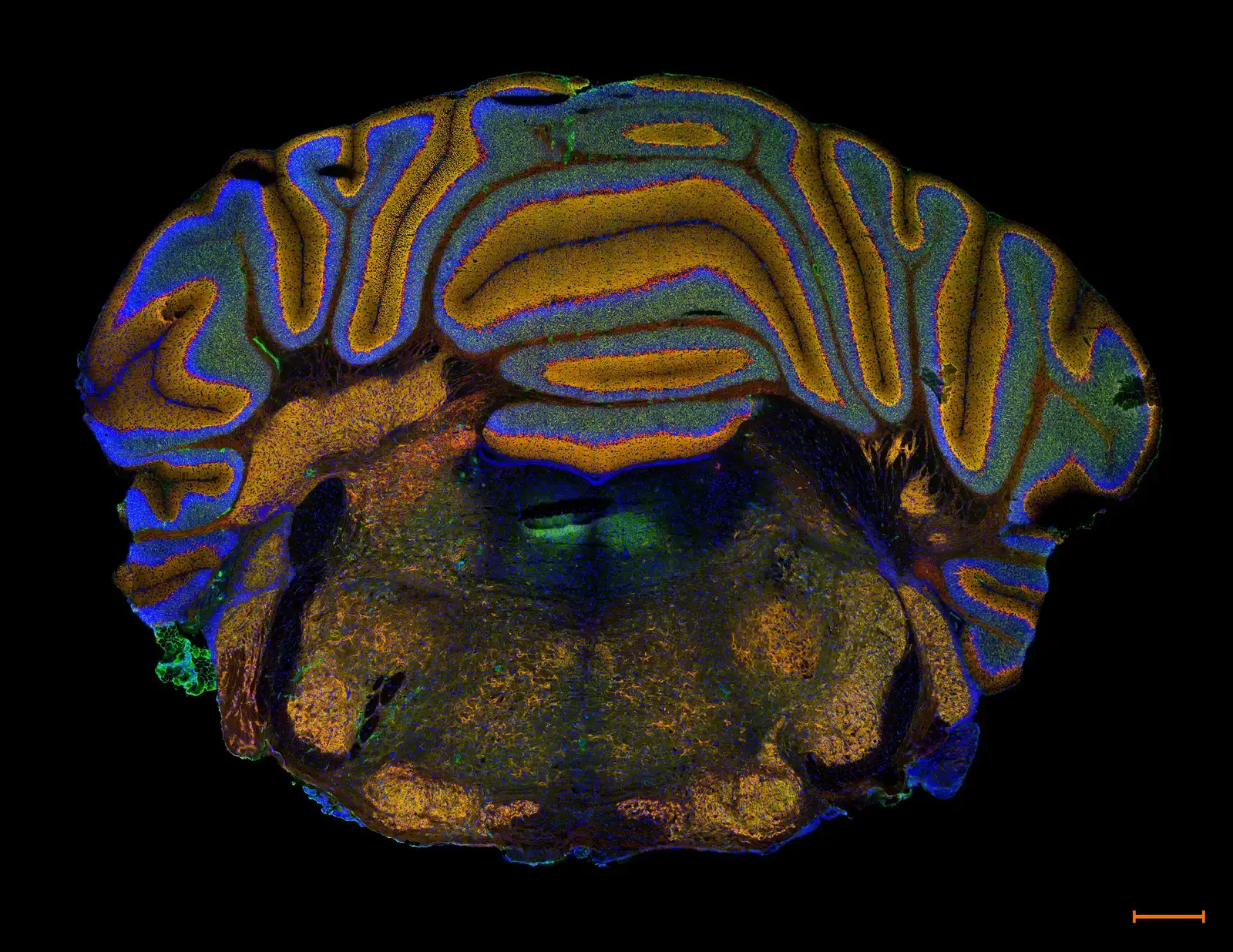 Mapping Memory at the Molecular Level: A Breakthrough Tool Called EPSILON (Image Credits: Wikimedia)