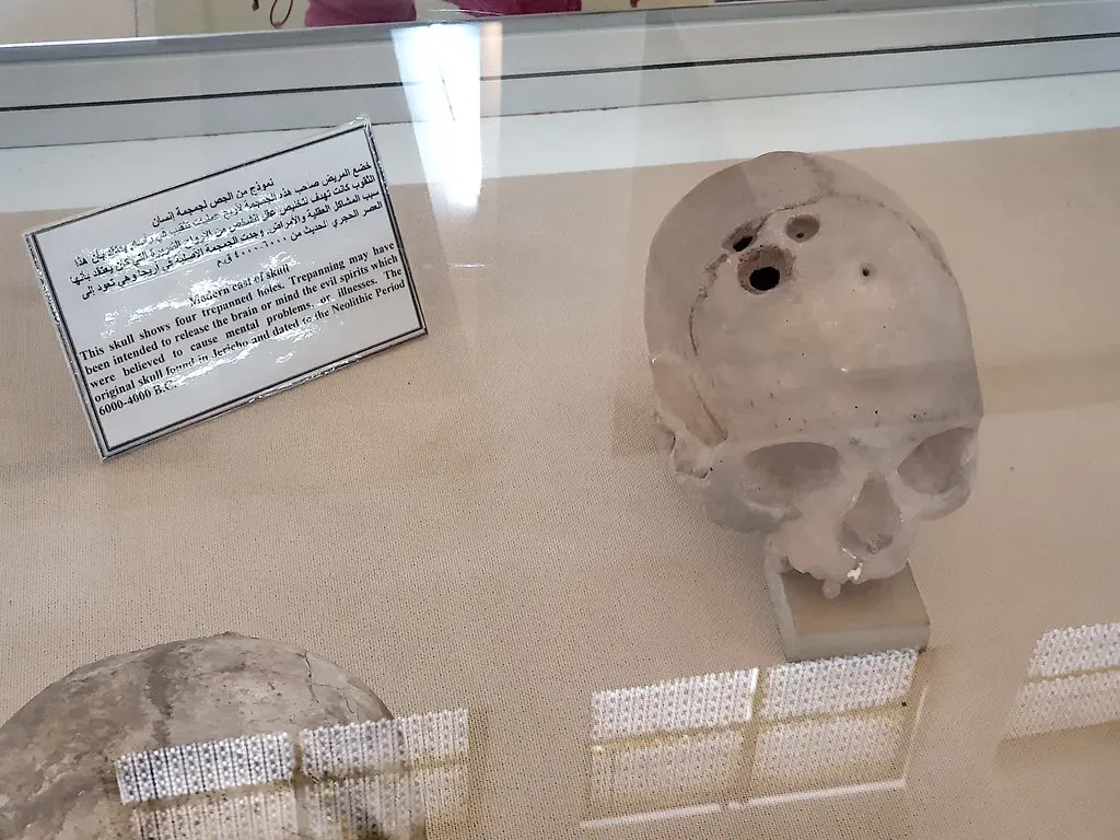 #3 - The "Torture" That Was Actually Ancient Brain Surgery (Image Credits: Flickr)