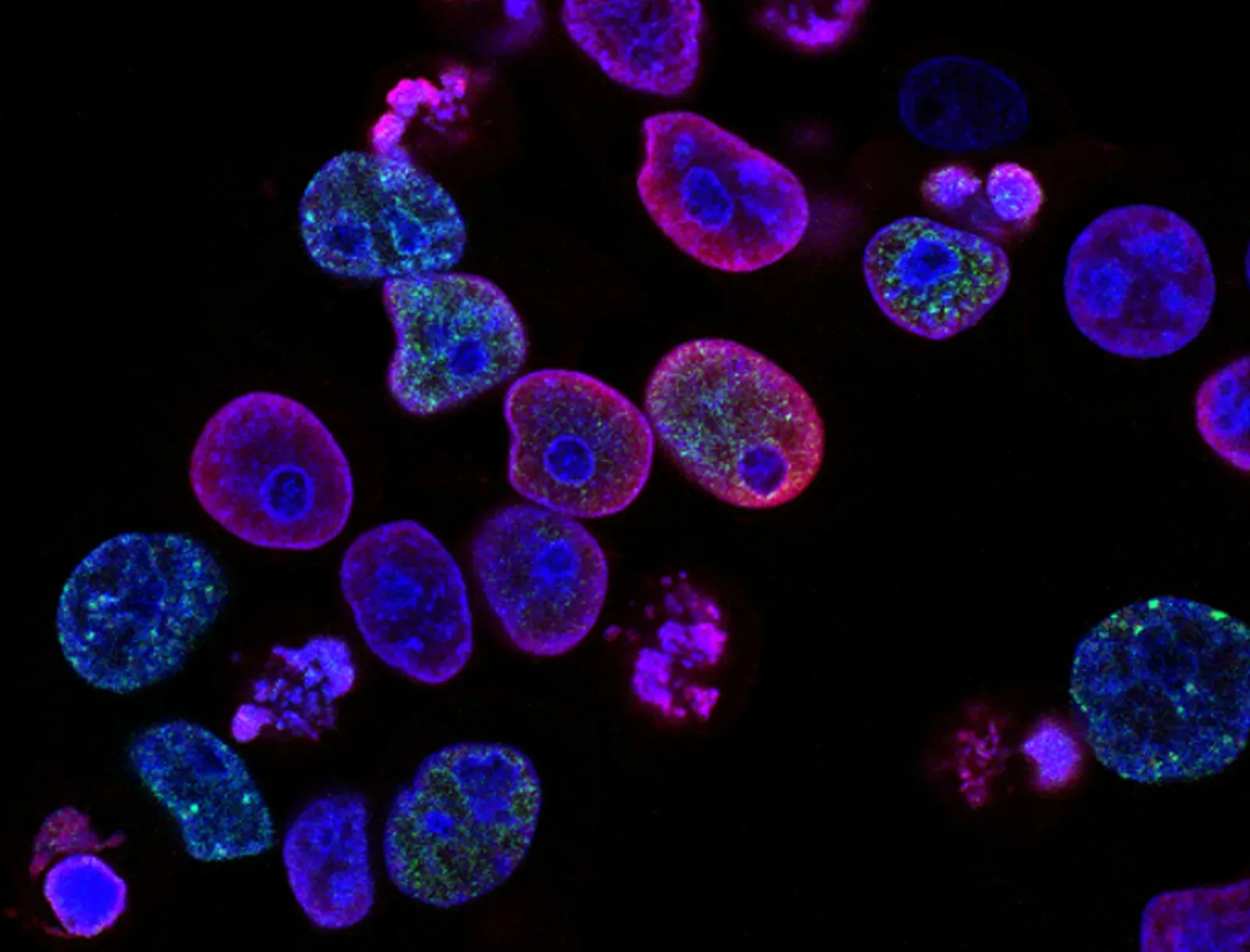 Cellular Damage: When Our Building Blocks Wear Out (Image Credits: Wikimedia)