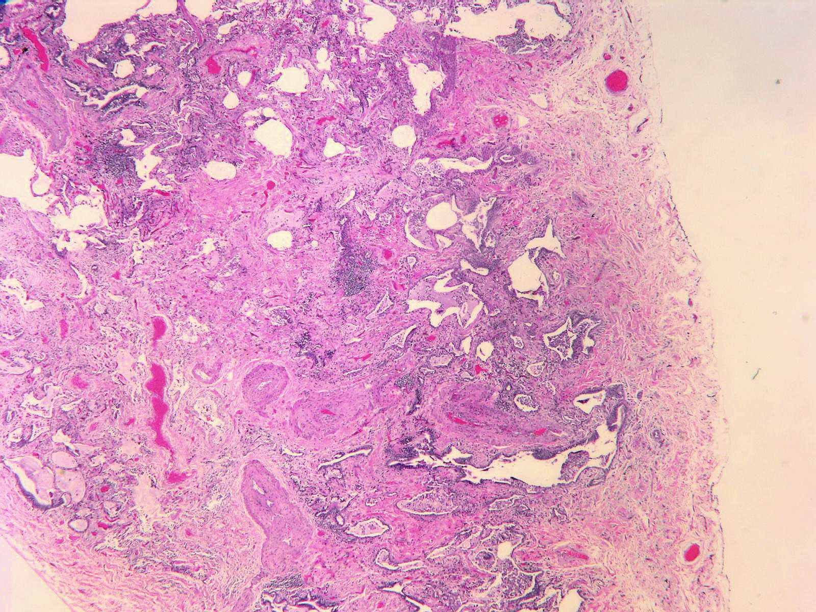 The Interstitium: Your Body's Hidden Highway (Image Credits: Wikimedia)