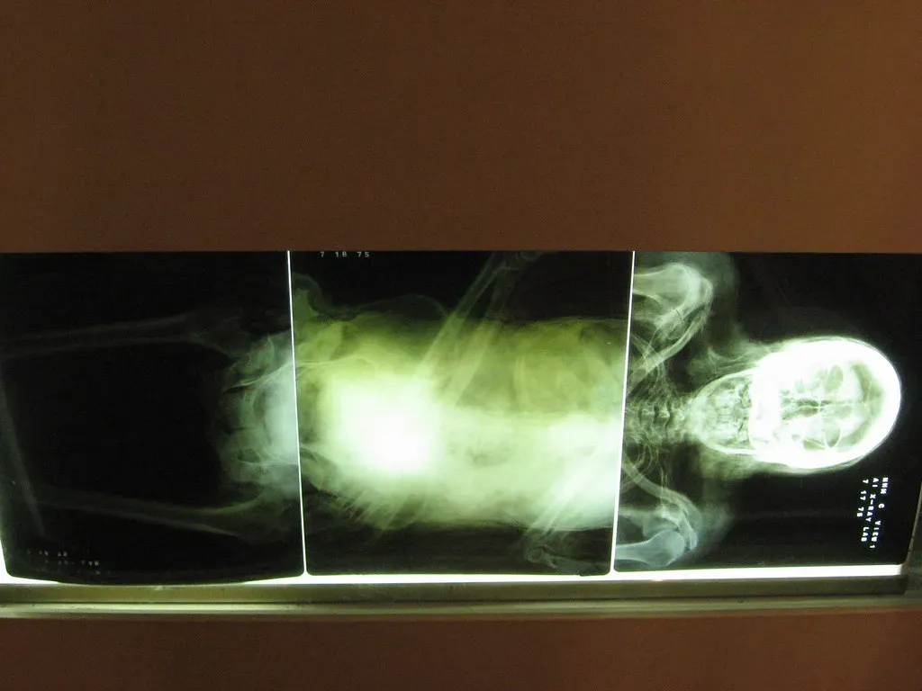 #10 - The X-Rayed Mummy That Broke the Narrative (auxesis, Flickr, CC BY 2.0)