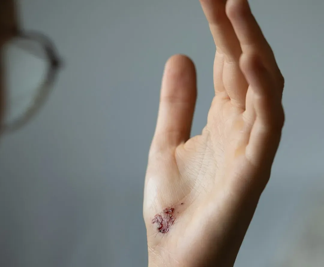 The Skin: Your Everyday Self-Repairing Armor (Image Credits: Unsplash)