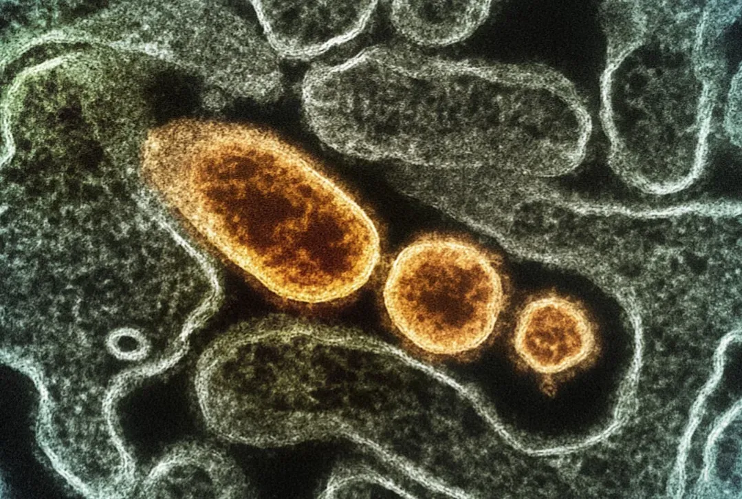 Microbes, pandemics, and prevention (Image Credits: Unsplash)