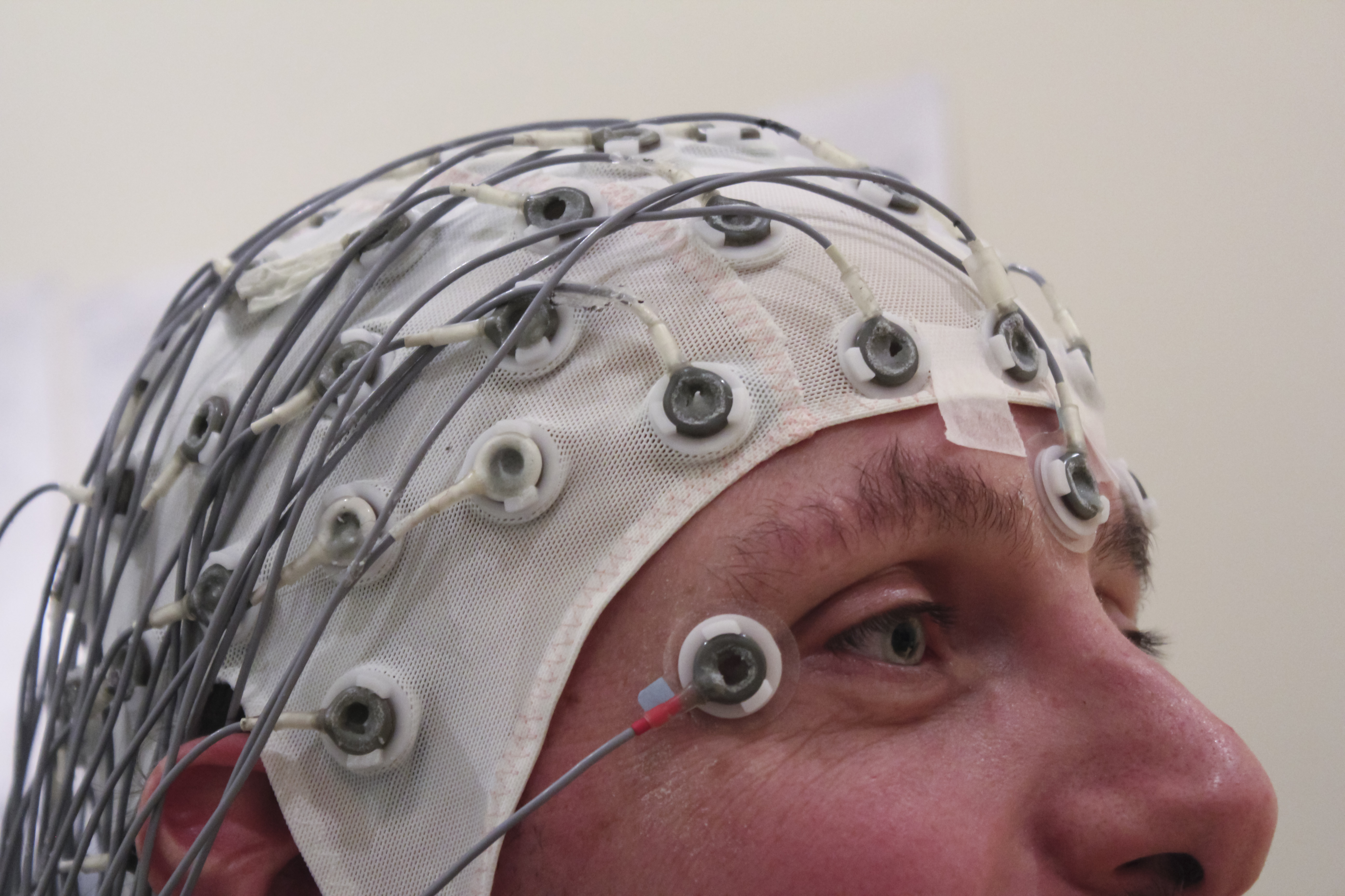 #6 Brain-Computer Interfaces (Image Credits: Wikimedia)