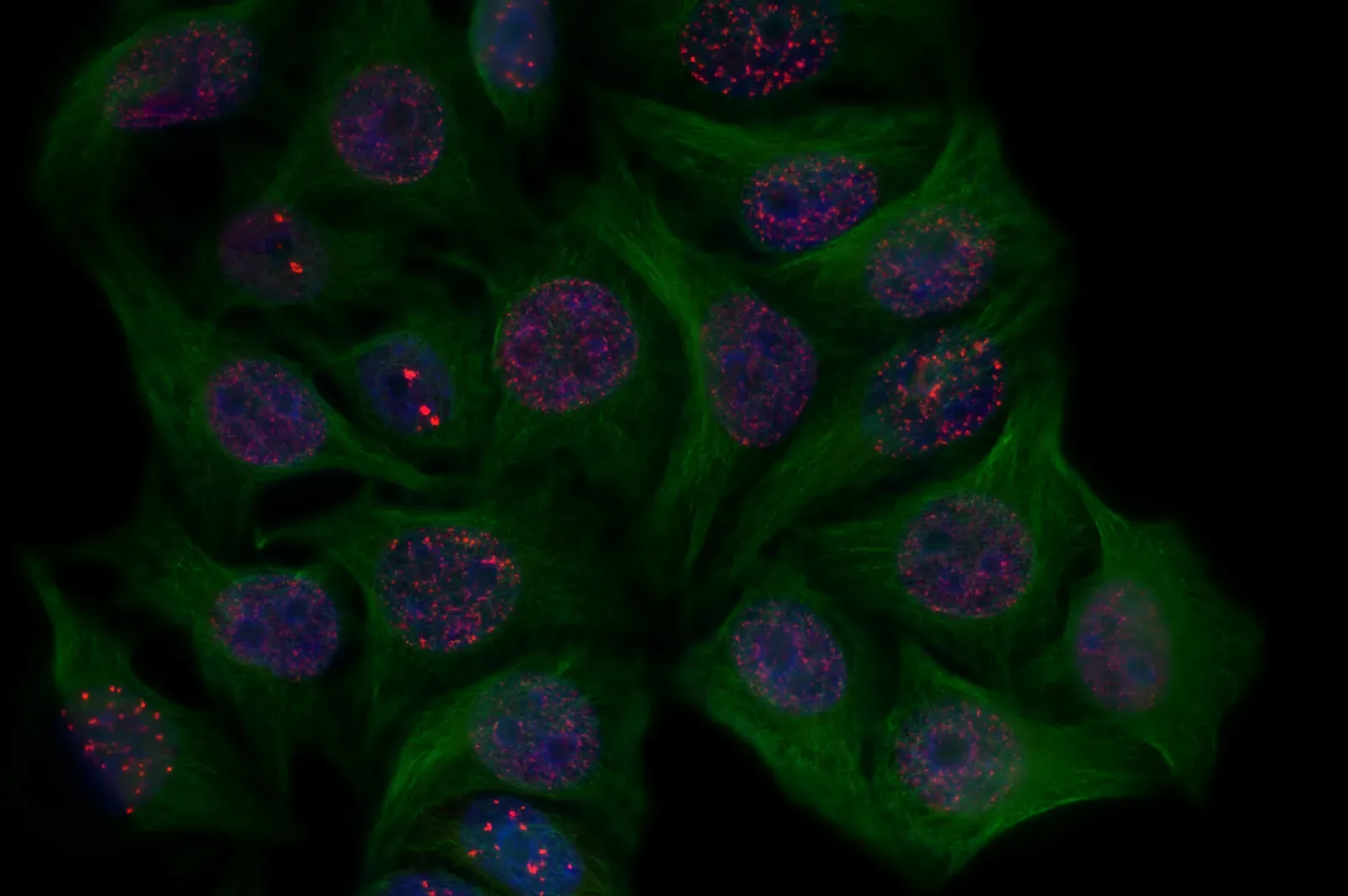 The Hallmarks of Aging: A Complex Web (Image Credits: Wikimedia)