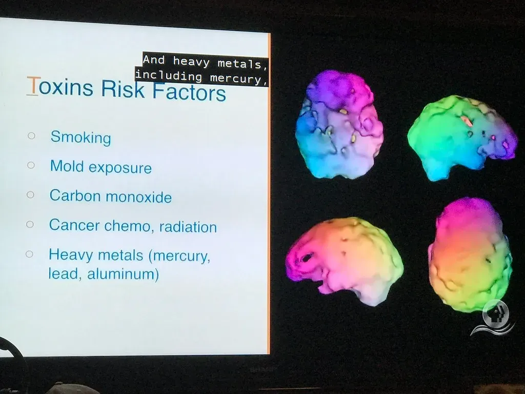 The Brain Under Threat: Microplastics, Metals, and Hidden Dangers (Chic Bee, Flickr, CC BY 2.0)