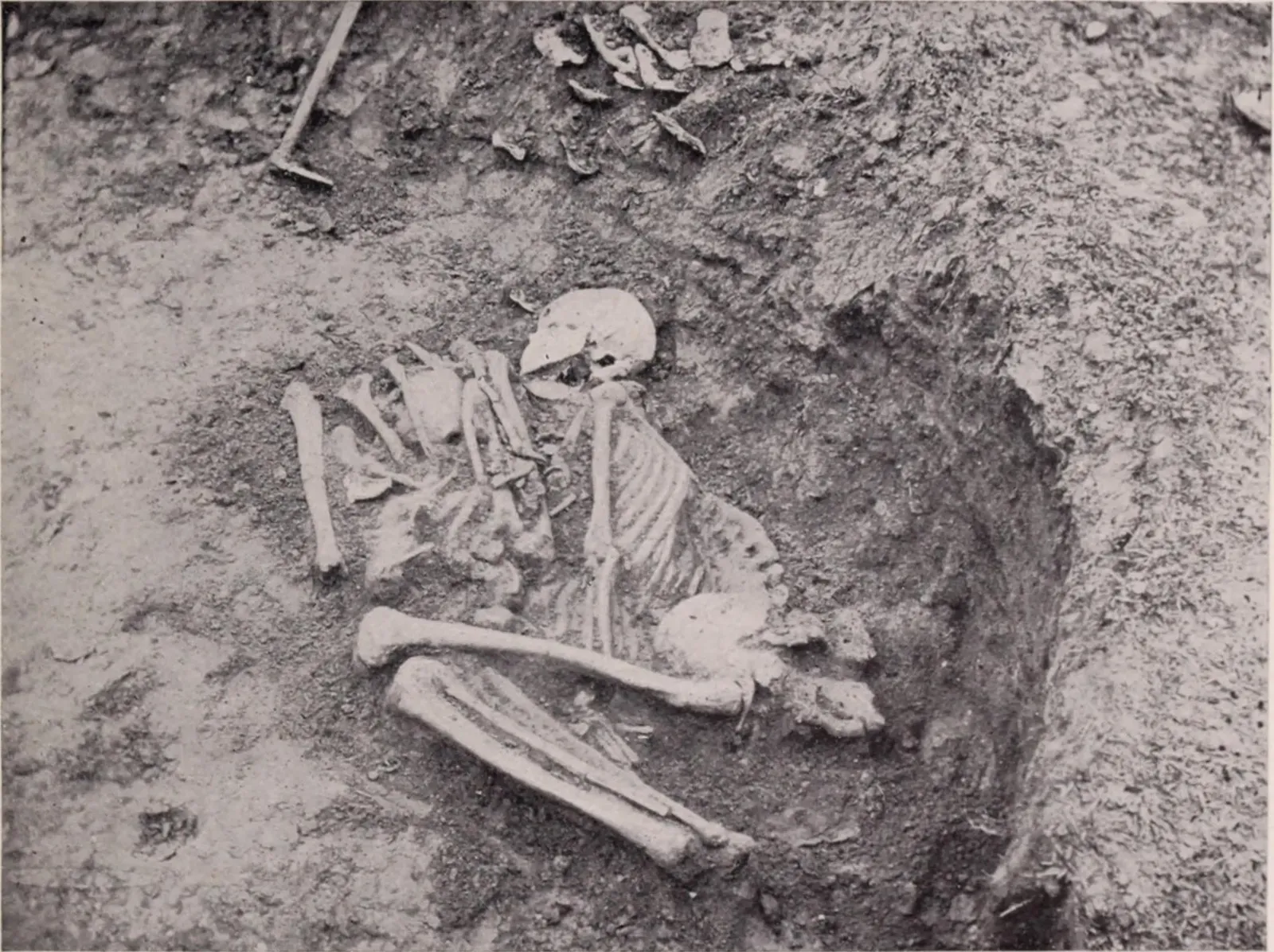 #9: Skeletons from Anonymous Mass Graves (By Internet Archive Book Images, No restrictions)