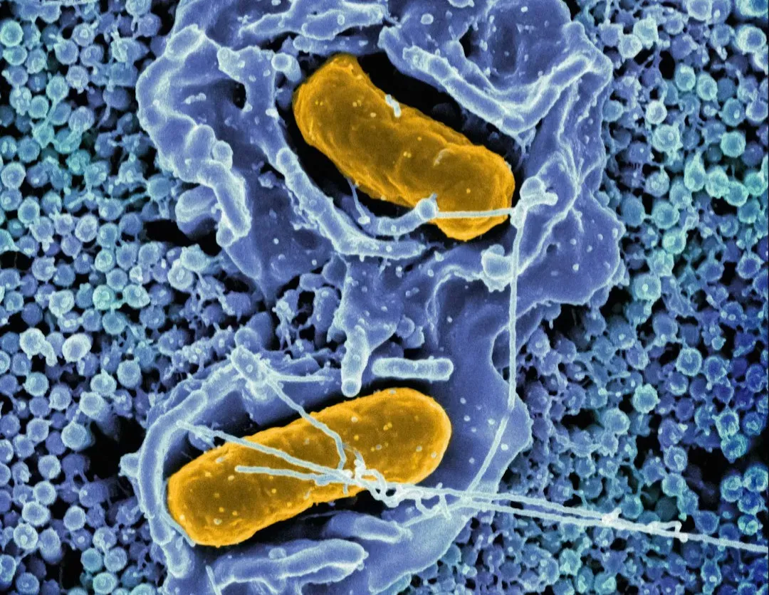 The Gut–Brain Connection: Microbes and Your Mood (Image Credits: Unsplash)