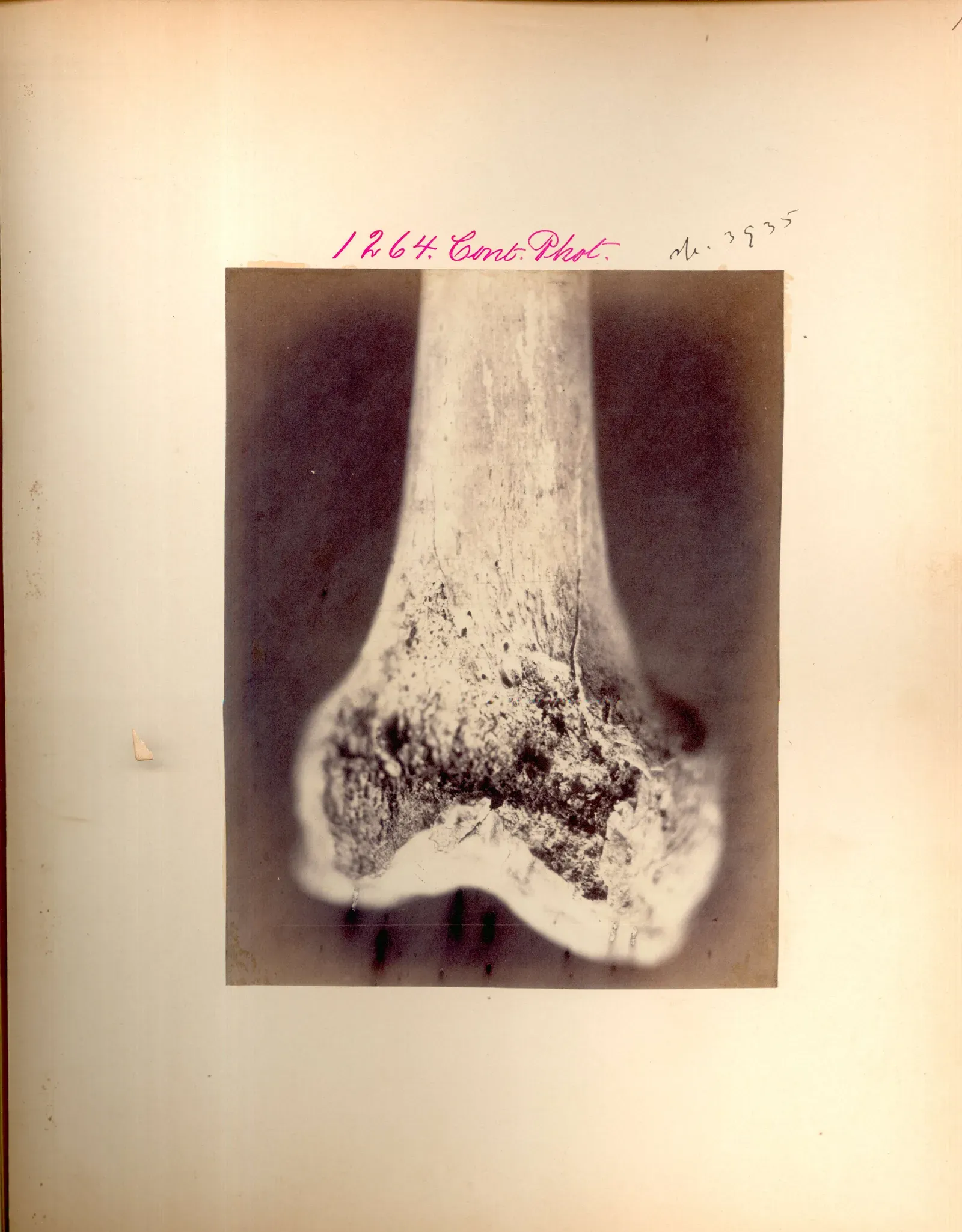 Everyday Actions: How You Can Help Your Bones Help Themselves (Image Credits: Wikimedia)