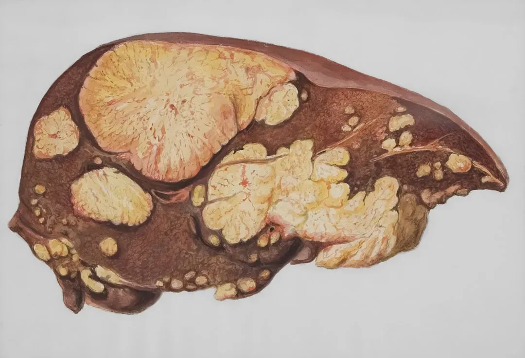 The Liver: The Body’s Quiet Workhorse Lab (Image Credits: Unsplash)