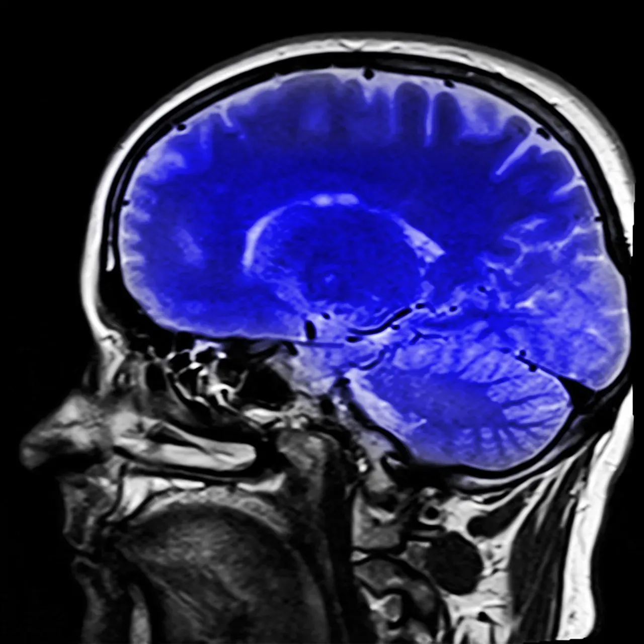 The Shocking Discovery: “Unresponsive” Does Not Mean “Unconscious” (Image Credits: Pixabay)
