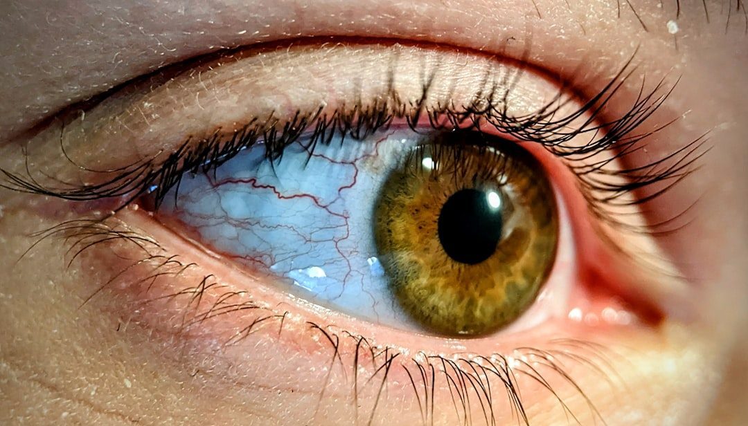 Your Eyes Can Heal Incredibly Fast (Image Credits: Unsplash)