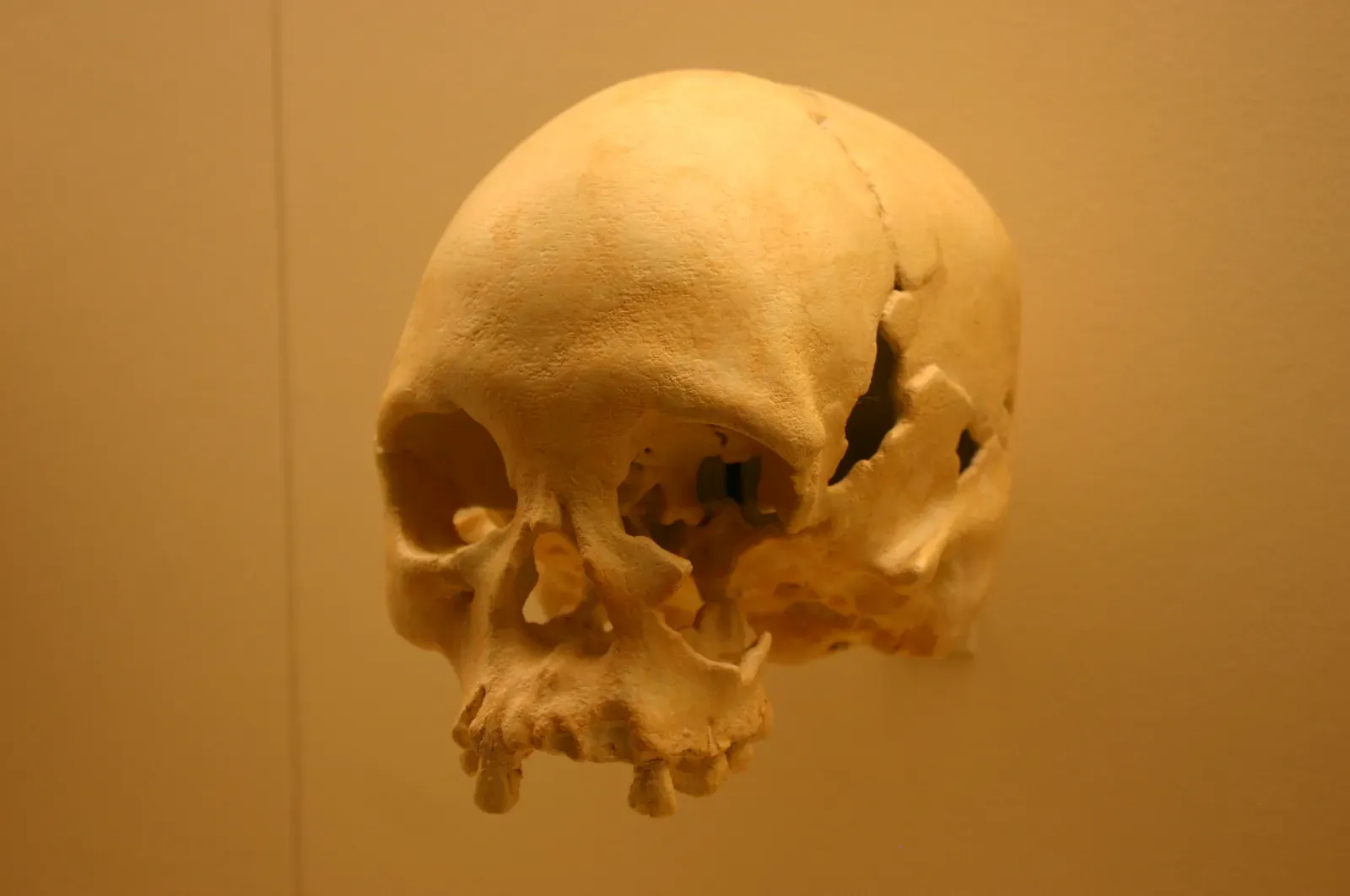 #3 - The "Micro-Hominid" Bones That Turned Out to Be Something Else (Homo Sapiens 11,500 Years Old, CC BY-SA 2.0)