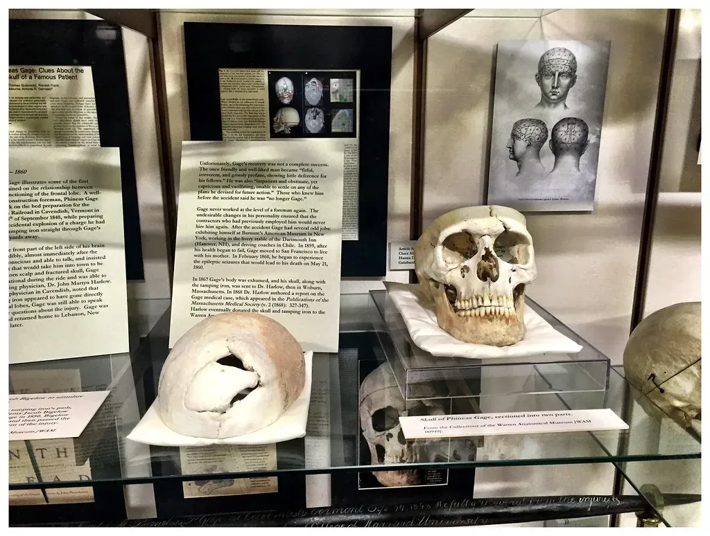 The Warren Anatomical Museum (Image Credits: Flickr)