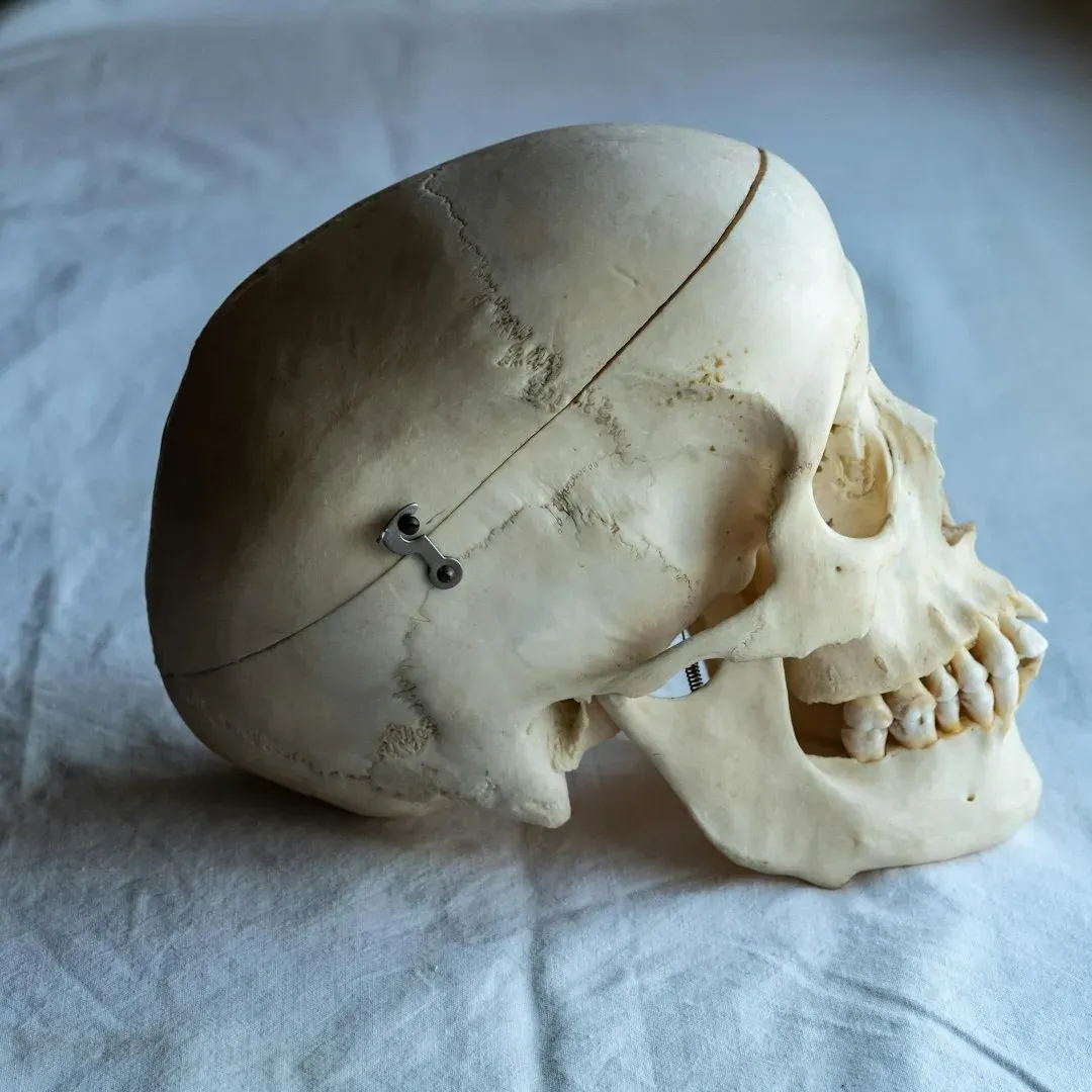 #8 - Fractures Reveal Whether Trauma Happened Before, During, or Long After Death (Image Credits: Unsplash)