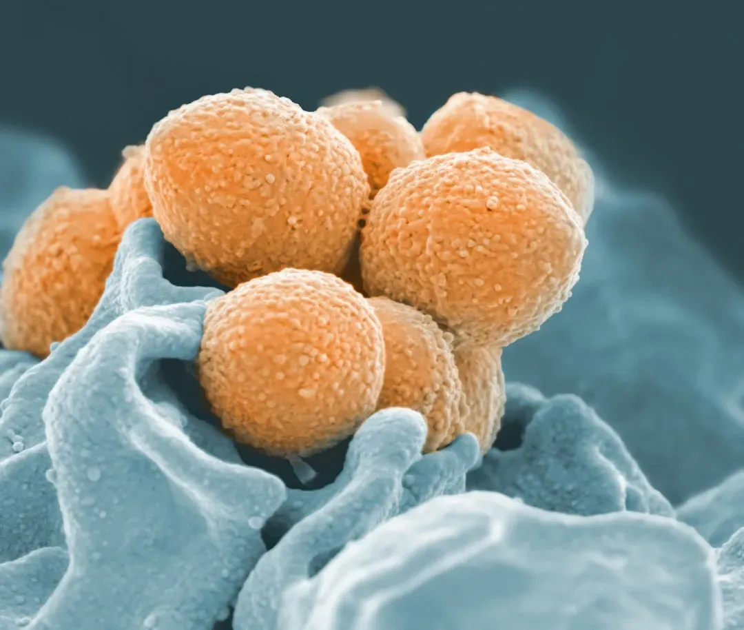 7. Staphylococcus Epidermidis: The Skin Bacterium That Shields You From Infection (Image Credits: Unsplash)