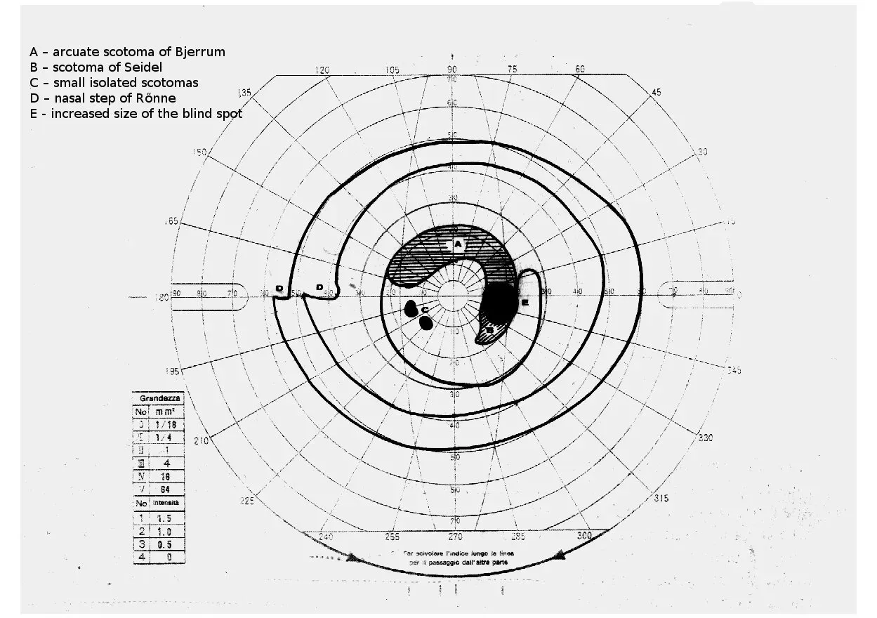 Why It Matters: Vision, Health, and the Limits of Our Perception (Image Credits: Wikimedia)