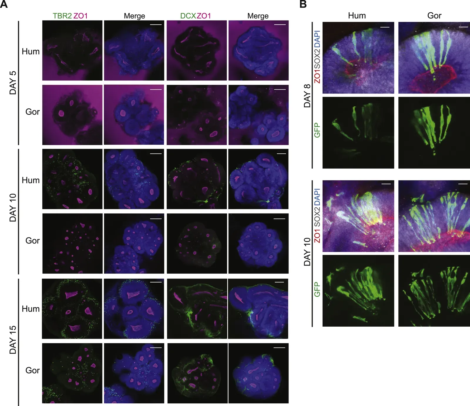 Place Cells and Grid Cells: The Tiny Neurons That Map Your World (By Authors of the study: Silvia Benito-Kwiecinski, Stefano L. Giandomenico, Magdalena Sutcliffe, Gregory A. Wray, Kate McDole, Madeline A. Lancaster, CC BY 4.0)
